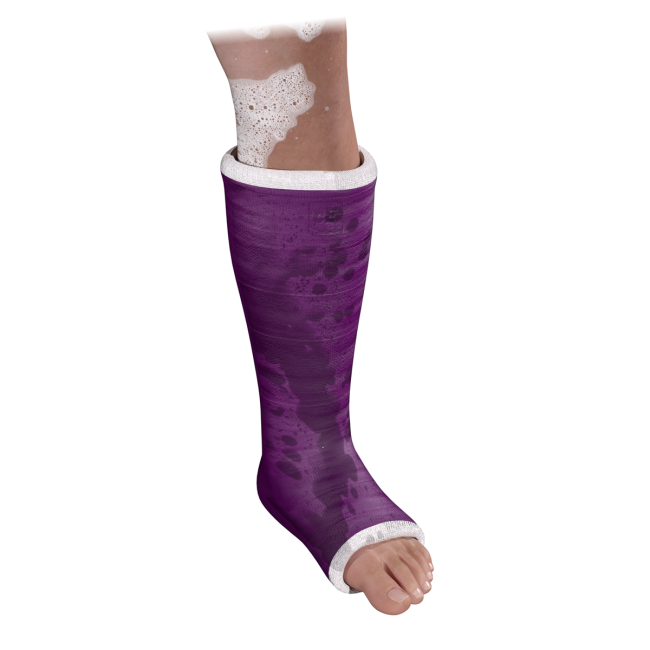 ALTOCAST Set Unterschenkel (wasserfest)